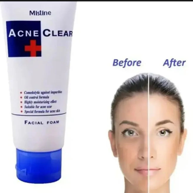 Mistine Acne Clear Facial Foam 85ml