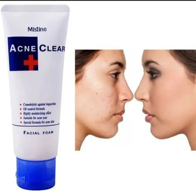 Mistine Acne Clear Facial Foam 85ml